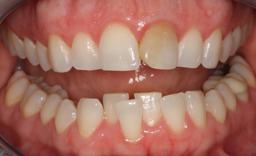 dc-c2-before2