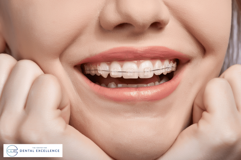 Closeup of smiling girl showing traditional braces